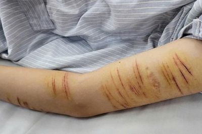 Trẻ vị thành niên và hành vi tự gây thương tích: Đừng để mạng xã hội thay thế kết nối gia đình