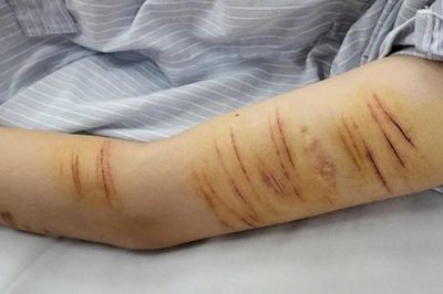 Khi mạng xã hội kéo trẻ vào vòng xoáy tự gây hại bản thân