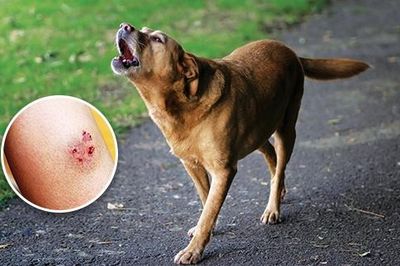 Chó rông cắn 2 trẻ em: Mẫu bệnh phẩm dương tính với virus dại