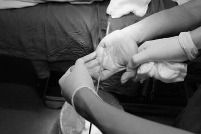 Thanh sắt đâm xuyên bàn tay, bác sĩ cảnh báo không tự ý rút dị vật