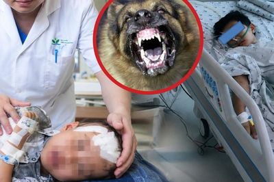Chó dại bất ngờ xông vào nhà cắn 2 em nhỏ trọng thương