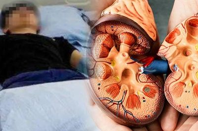 Uống loại nước này suốt 1 năm, du học sinh Nhật Bản bàng hoàng mắc suy thận