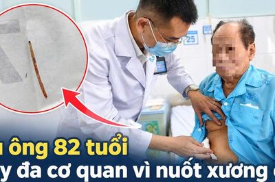 Cụ ông 82 tuổi suy đa cơ quan, sốc nhiễm trùng vì nuốt phải xương cá
