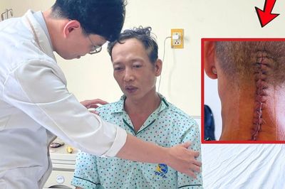 Ngã võng sau cuộc nhậu, người đàn ông 43 tuổi gãy đốt sống cổ