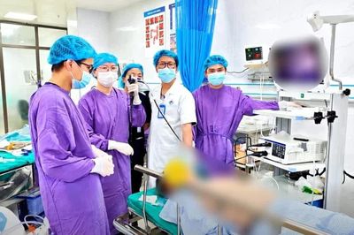 Ho, khó thở suốt 1 tháng, người đàn ông phát hiện dị vật trong phế quản