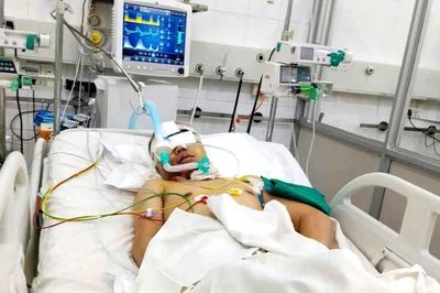 Nửa đêm đi đón bạn, nam thanh niên Bắc Ninh gặp tai nạn nguy kịch