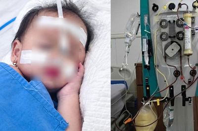 Từ cơn sốt thông thường, bé 2 tuổi hôn mê gan suýt chết