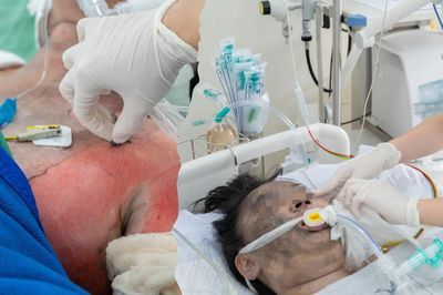 Tình hình sức khỏe 5 nạn nhân vụ cháy nhà giữa đêm ở TPHCM