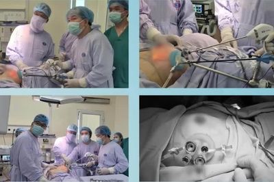 43 tuổi tình cờ phát hiện ung thư vú, phẫu thuật cắt tuyến vú và tái tạo