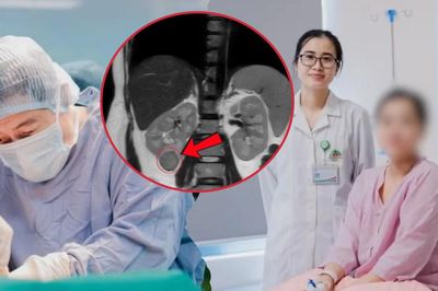 Phát hiện khối u hiếm gặp từ dấu hiệu tăng huyết áp trong thai kỳ