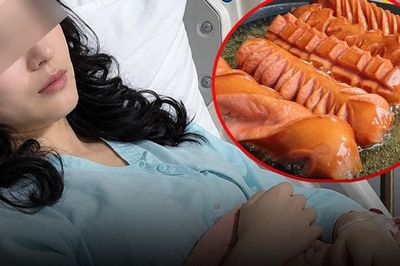 28 tuổi mắc bệnh thận, cô gái bàng hoàng khi biết nguyên nhân từ 2 món ăn yêu thích