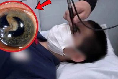 Bạn bật ô che mưa, nam sinh bị vỡ nhãn cầu có thể mù vĩnh viễn