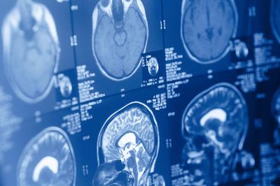 Phát hiện bất ngờ: Não người là hai cơ quan riêng biệt