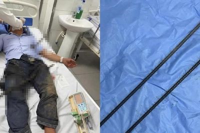 Báo động đỏ nội viện cứu sống bệnh nhân bị hai thanh sắt xuyên thấu