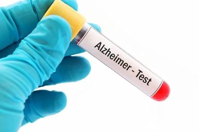 Triển vọng điều trị và phòng ngừa bệnh Alzheimer