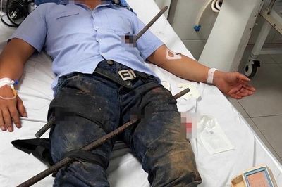 Kịp thời cứu bệnh nhân bị hai thanh sắt xuyên đùi và bụng