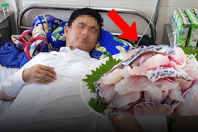 Cả nhóm 5 người cùng nhiễm sán lá gan sau bữa ăn có món gỏi cá