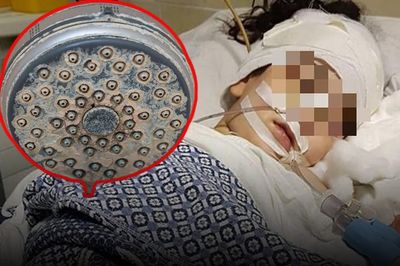 Người phụ nữ ho suốt 3 năm phát hiện thủ phạm trong chiếc vòi sen cũ