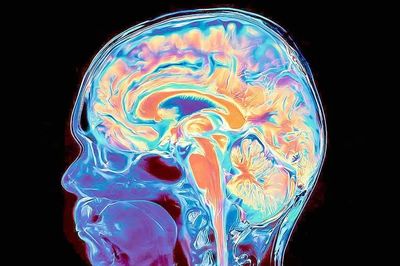 Phát hiện não người phát triển từ hai hệ tế bào riêng biệt