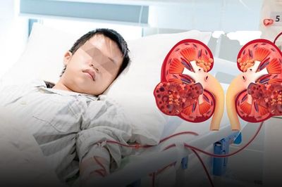 Mới 16 tuổi đã suy thận cấp, chi chít sỏi đầy hai quả thận