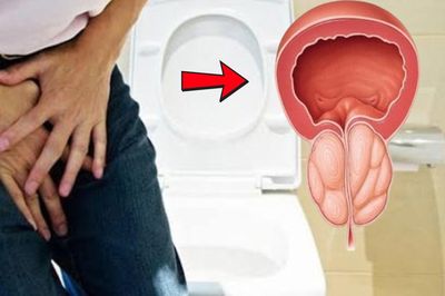 Tiểu khó suốt 10 năm, người đàn ông phát hiện tuyến tiền liệt lớn bất thường