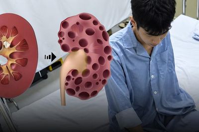 Ông bố trẻ 24 tuổi chết lặng khi nhận kết quả suy thận giai đoạn cuối