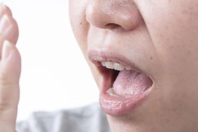 9 dấu hiệu thận đang 'kêu cứu'