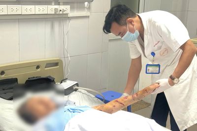 Người cao tuổi cần cảnh giác tổn thương nặng do chó cắn