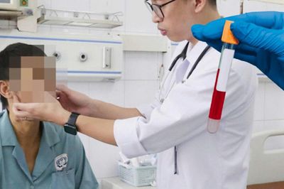 Uống thuốc nam, người đàn ông nhập viện với chỉ số bilirubin cao gấp 42 lần