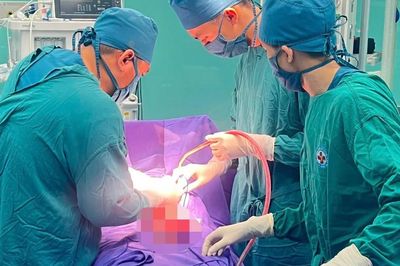 Bụng to bất thường, người phụ nữ bất ngờ phát hiện khối u nặng 4 kg