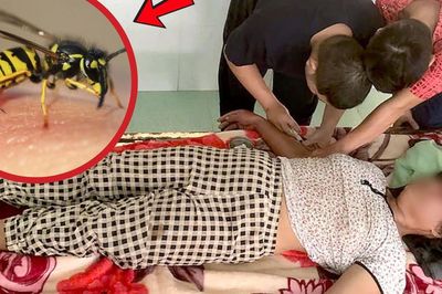 Người phụ nữ hôn mê vì ong vò vẽ đốt 20 nốt khi đi chăn bò