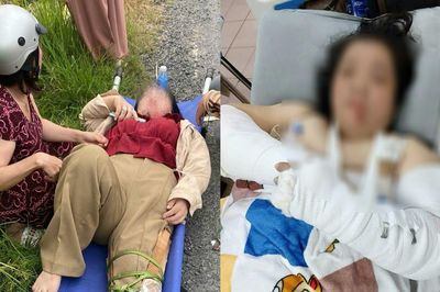 Liên tiếp 3 vụ tai nạn trên đoạn đường chi chít ổ gà, có cô giáo gãy cả tay và chân