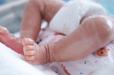 Gia đình hốt hoảng khi bé trai sơ sinh da nứt nẻ như vảy cá