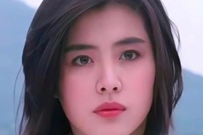 Biểu tượng nhan sắc lên tiếng về gương mặt biến dạng