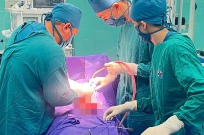 Bụng to bất thường, người phụ nữ phát hiện khối u nặng 4kg