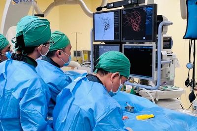 Người phụ nữ 50 tuổi đau đầu dữ dội trong lúc ngủ, đi khám phát hiện vỡ túi phình động mạch não