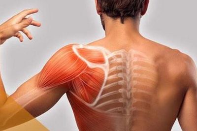 Viêm quanh khớp vai cần xử trí như thế nào?