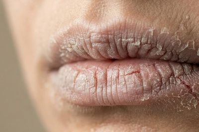 Lý do môi khô, da môi dễ bong vào mùa thu và cách khắc phục
