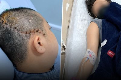 Đang ăn cơm cùng chồng, người phụ nữ đột ngột lịm đi, vỡ mạch máu não