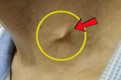 Cổ sưng đau, không thể ăn uống suốt nhiều ngày, bác sĩ phát hiện điều bất ngờ