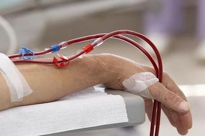Chức năng thận thay đổi thế nào khi thường xuyên dùng dầu dừa?