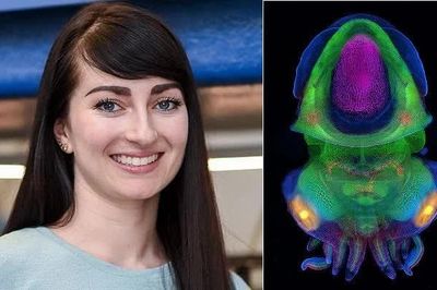 Biến đổi gene mực nang để theo dõi hoạt động của tế bào thần kinh