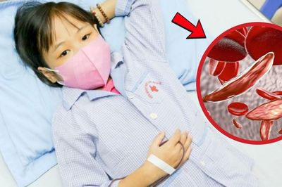Giải mã nguyên nhân bố mẹ khỏe mạnh sinh con mắc bệnh tan máu bẩm sinh