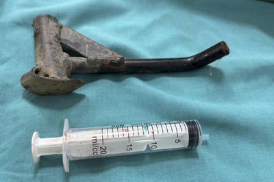 Đà Nẵng: Phẫu thuật cứu nạn nhân bị chân chống xe đâm xuyên cẳng chân sau va chạm