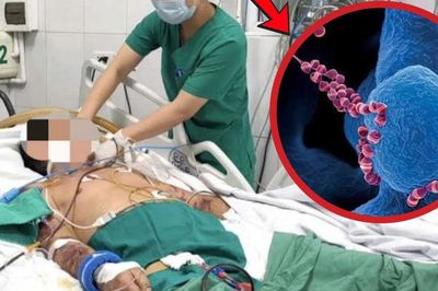 Người đàn ông 61 tuổi suy đa tạng, xuất huyết hoại tử vì thói quen phổ biến