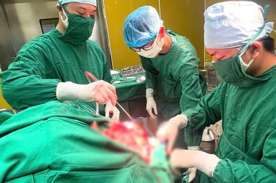 Ghép mảnh sọ tự thân đặc biệt cho bệnh nhân chấn thương sọ não nặng