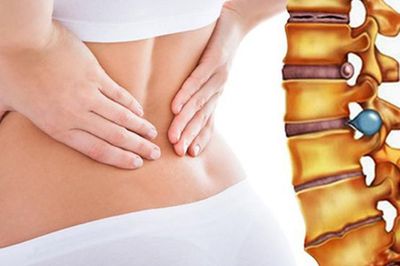 Thoát vị đĩa đệm khi nào cần phẫu thuật?