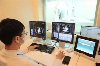 Chụp CT vùng ngực hé lộ nguy cơ suy giảm nhận thức sớm