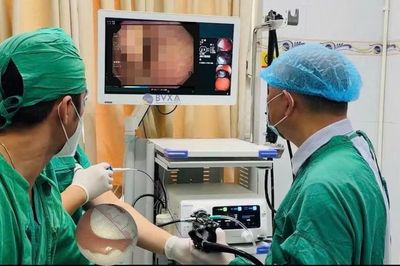 Đang uống nước, người đàn ông 51 tuổi bất ngờ nuốt nhầm thứ khó tin