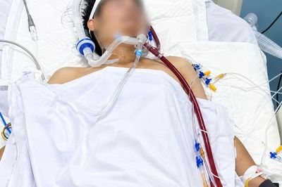 'Em nó mới hơn 30 tuổi sao lại đột quỵ' - câu hỏi khiến bác sĩ xót xa